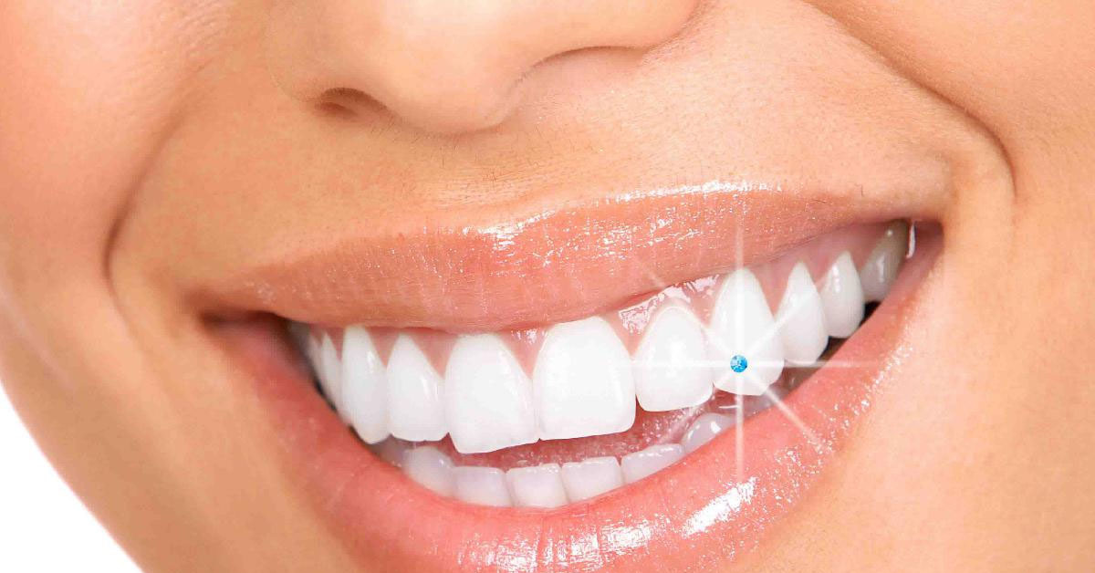 Tooth Jewellery